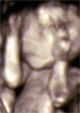 22. hetes baba