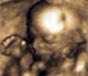 19. hetes baba