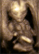 17. hét