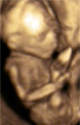 21. hetes baba