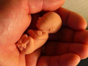 A magzat élethez való joga - Lehet-e magánügy az abortusz?