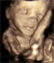 24. hetes baba